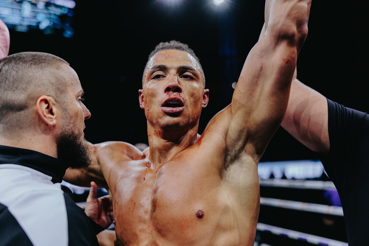 Champ