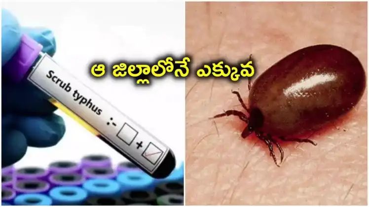 PublicVoic86788's tweet photo. ఏపీలో స్క్రబ్ టైఫస్ కలవరపెడుతోంది. ఇప్పటి వరకు 22 మంది మృతి, 2 వేలకుపైగా కేసులు నమోదు. చిత్తూరు, తిరుపతి, కాకినాడ, విశాఖ జిల్లాల్లో ఎక్కువ ప్రభావం. వ్యాధి నియంత్రణకు ప్రభుత్వం టాస్క్‌ఫోర్స్ ఏర్పాటు.
#ScrubTyphus #APHealth #AndhraPradesh #PublicHealth #APNews #HealthAlert https://t.co/7Y55Bh14LI