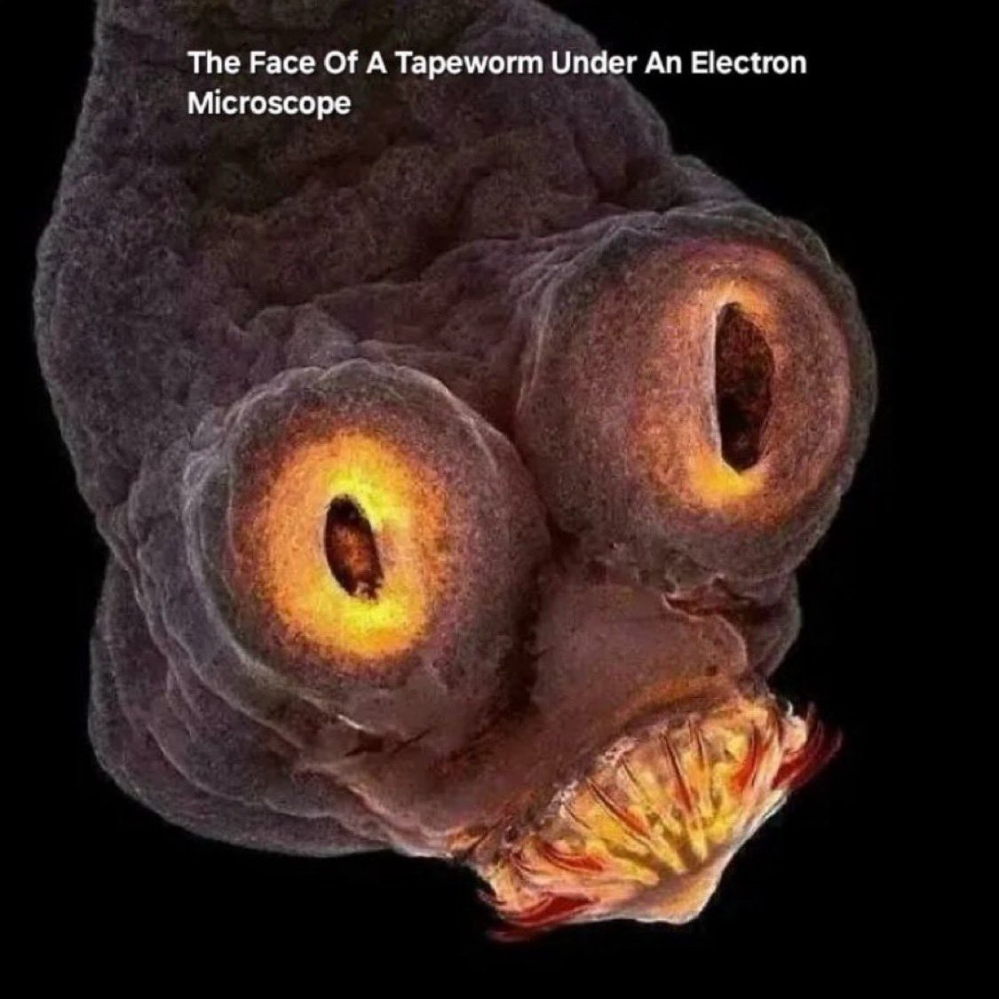 TheRoyalSerf's tweet image. Face of tapeworm under microscope