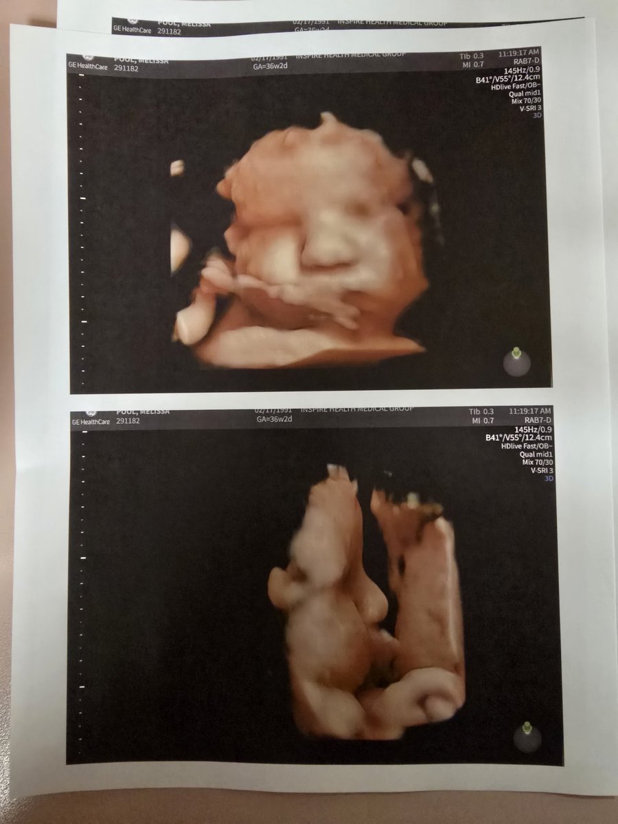 Meli🍯🐝 tweet media