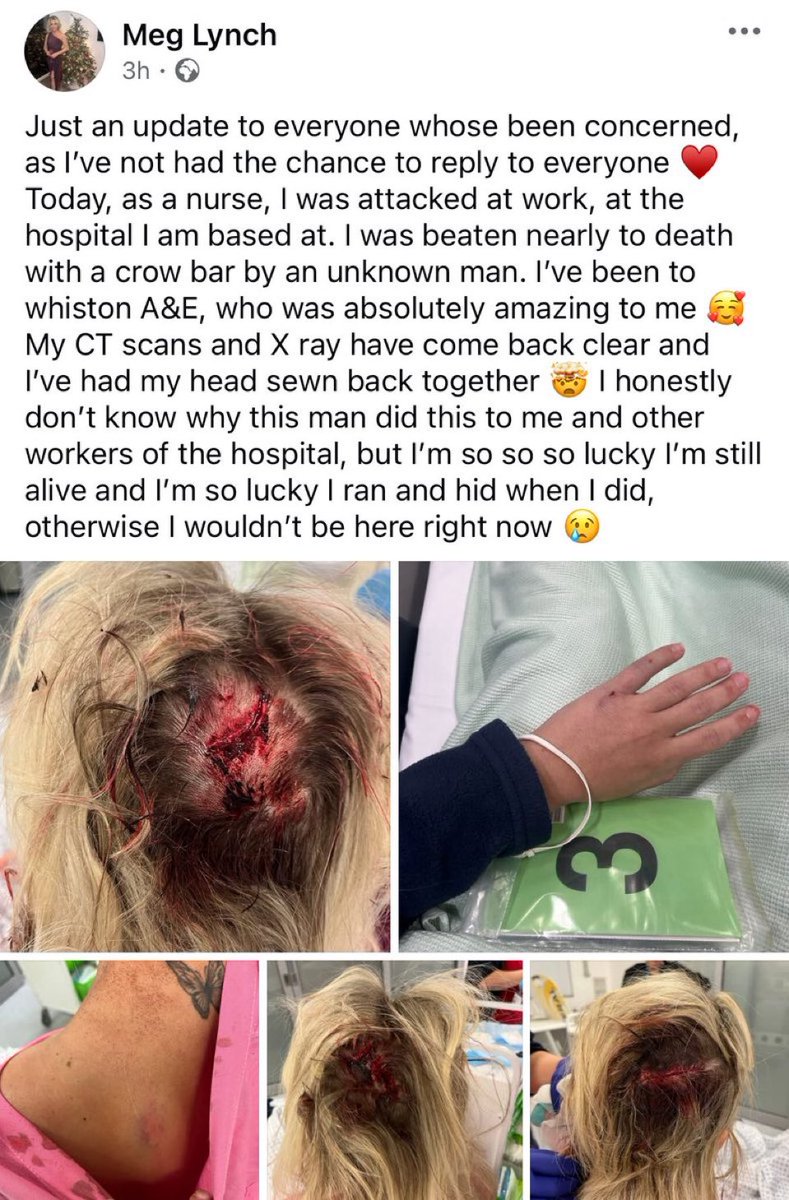 Barn_CF's tweet image. Remember when ‘protecting the NHS’ was the government mantra during Covid? Now they’re importing Afghan animals intent on killing its workers. We don’t have to live like this