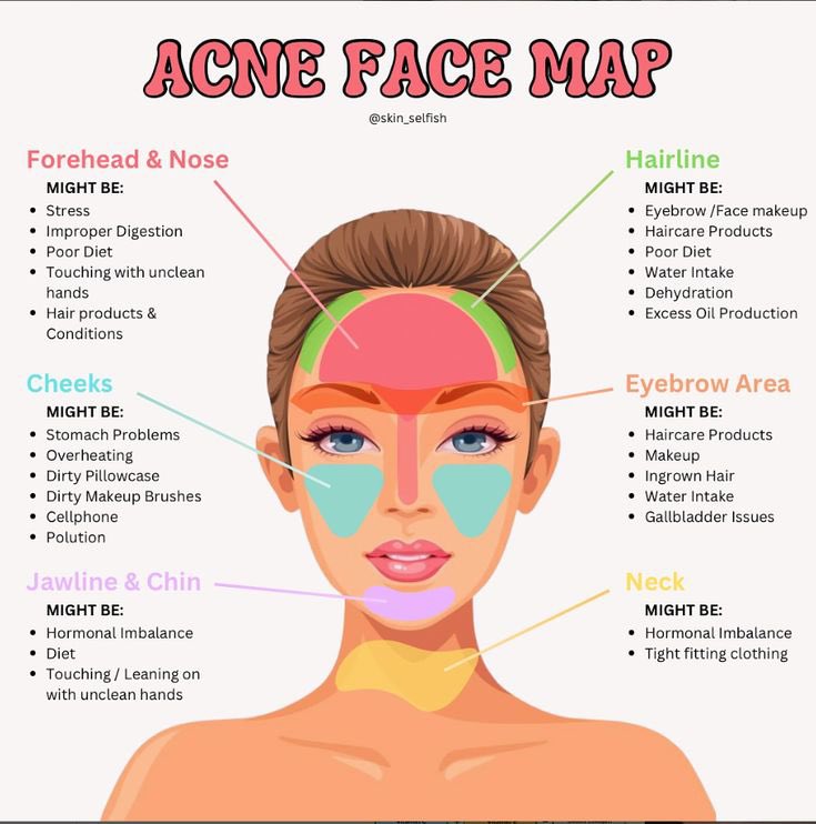 Maureen Waititu tweet media