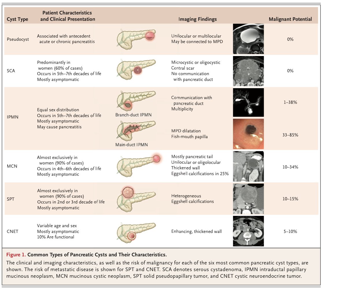 AchintyaSinghMD's tweet image. Excellent illustrations, review of pancreas cysts: nejm.org/doi/full/10.10…
➡️ 15% panc cancer arise from cysts
➡️ EUS&amp;gt;MRI: connection with ducts, ampulla evaluation, mural nodules 
➡️VHL: Serous, MEN: NET, KRAS or GNAS: IPMN, GTNNB1: SPNT
➡️Minimal surgical excision is an option!