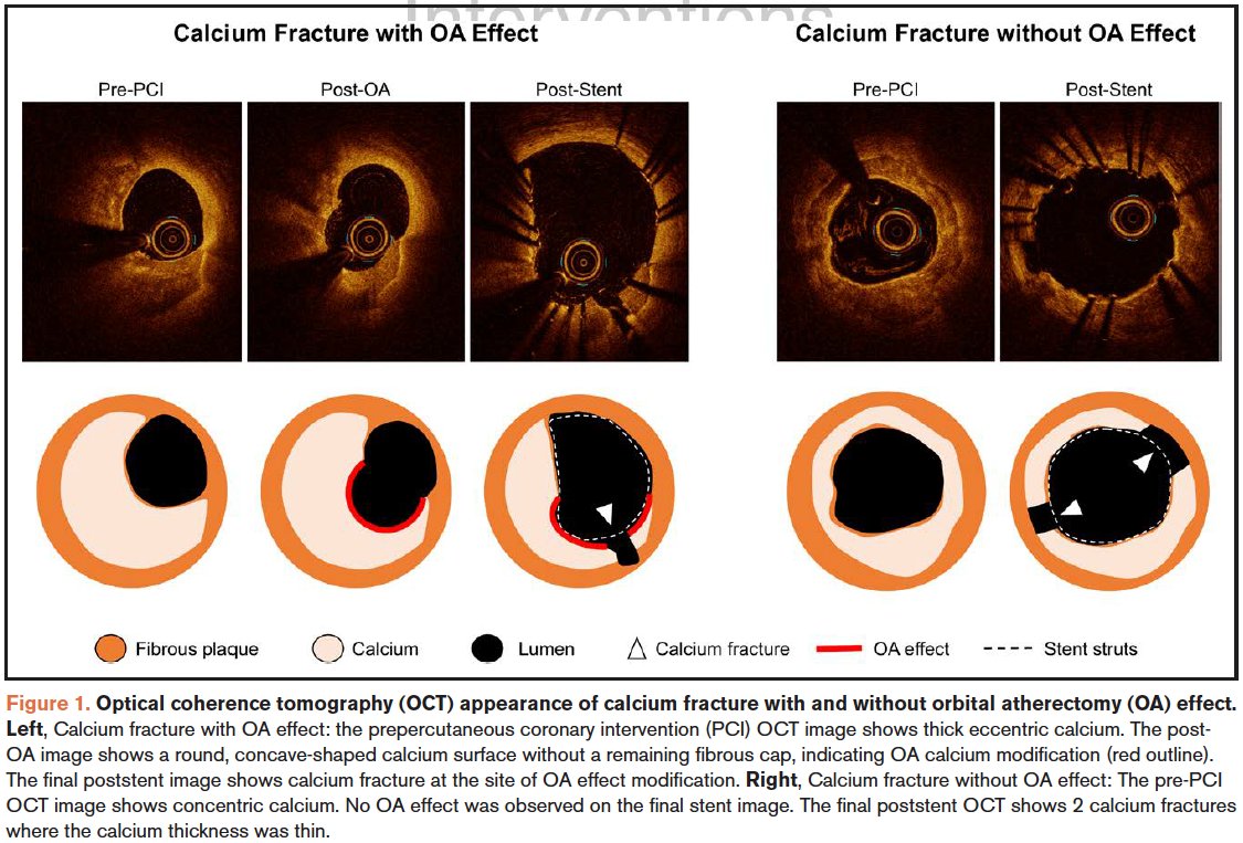 Gregg W. Stone MD tweet media