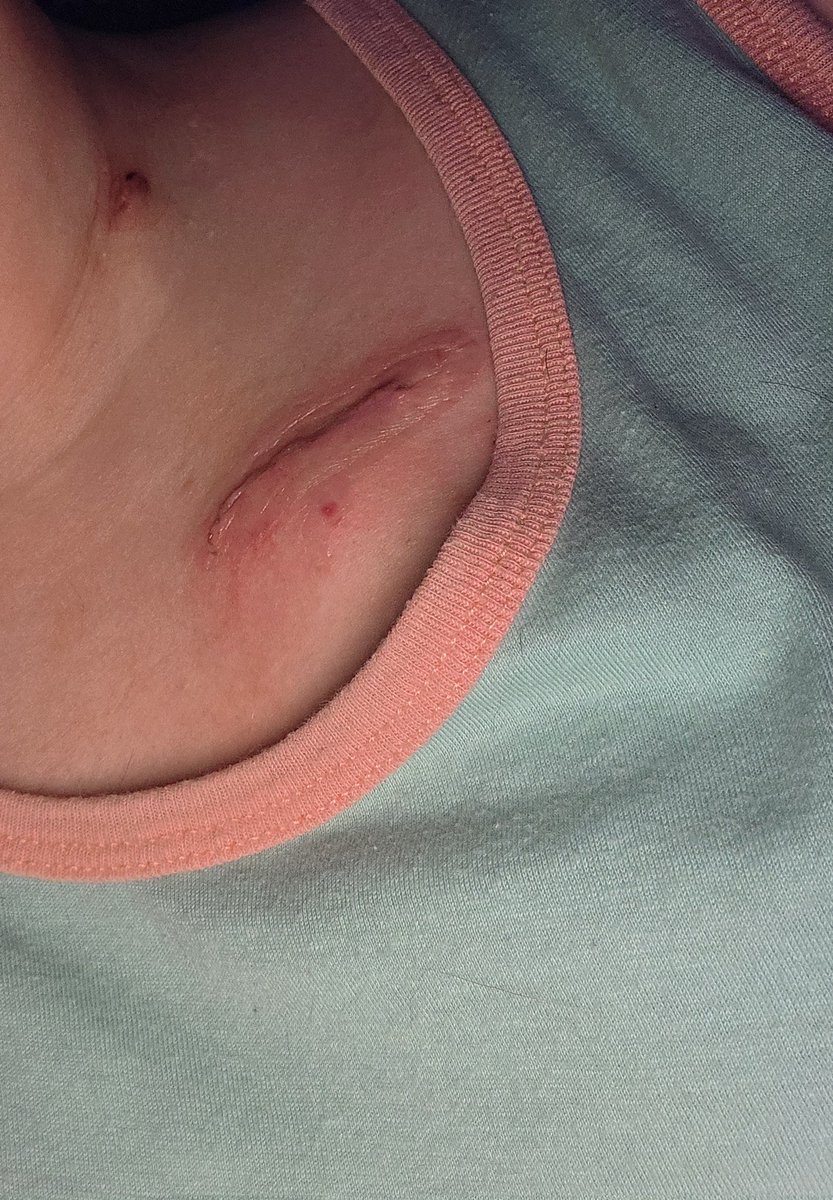 Frizz 🐱❄️currently fighting cancer tweet media