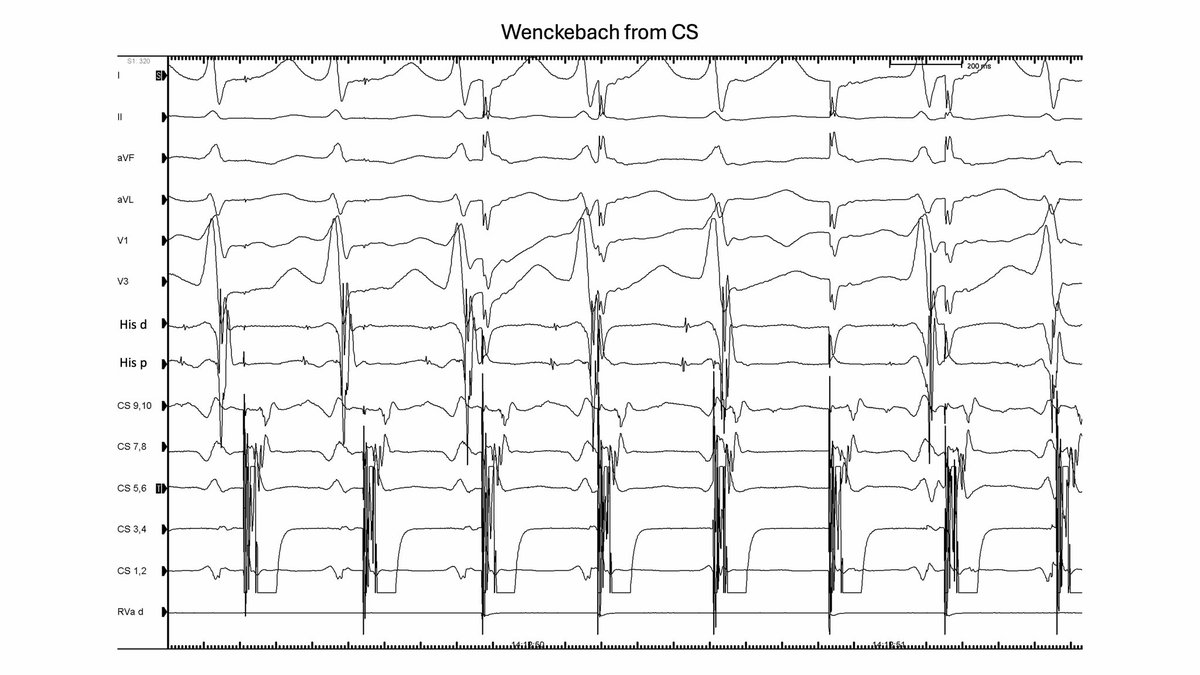 Luis Quininir, MD ECES FACC 🇨🇱 tweet media