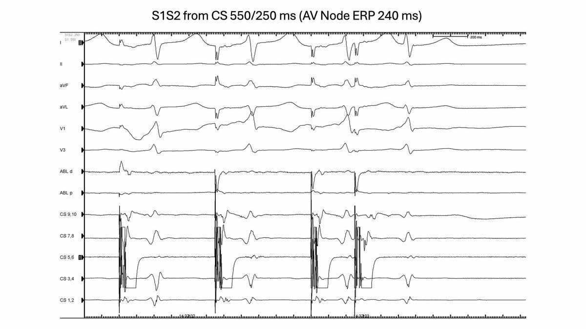 Luis Quininir, MD ECES FACC 🇨🇱 tweet media