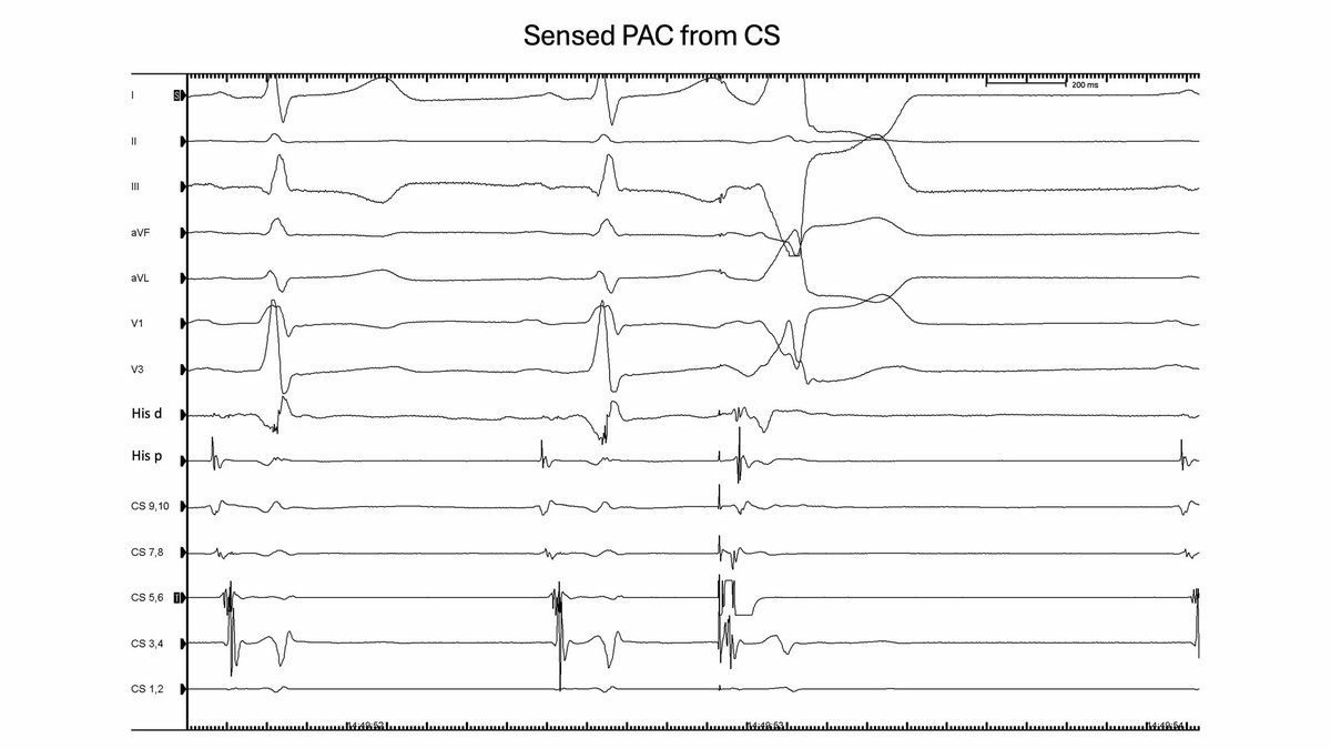Luis Quininir, MD ECES FACC 🇨🇱 tweet media
