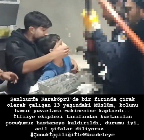 Şanlıurfa Karaköprü'de bir fırında çırak olarak çalışan 13 yaşındaki Müslüm, kolunu hamur yuvarlama makinesine kaptırdı..
İtfaiye ekipleri tarafından kurtarılan çocuğumuz hastaneye kaldırıldı, durumu iyi, acil şifalar diliyoruz..
#ÇocukİşçiliğiİleMücadeleye
