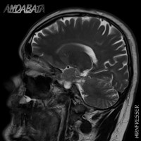 Andabata_Nbg's tweet image. Unsere aktuelle CD EP "Hirnfresser" gibt es jetzt für nur 8.- Euro plus Porto in unserem Shop auf andabata.de
#cd #audiocd #shop #merch #bandmerch #deathmetal #deathmetalduo #undergroundmetal #heavymetal #cdcollector