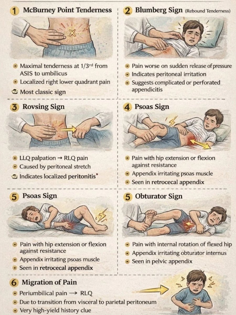 Acute Appendicitis signs. 

instagram.com/p/DS4VCWHkSkj/…