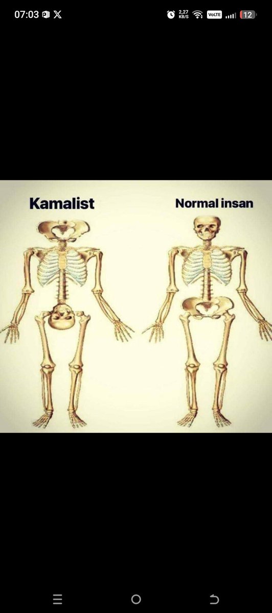 <a href="/zekibahce/">Zeki Bahçe</a> ECE Üner de biliyor kitlesi müsait