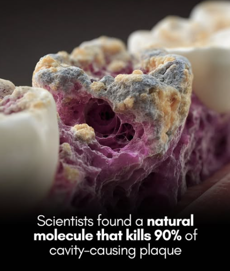 Compound found in broccoli kills 90% of cavity-causing bacteria.

Scientists have discovered that a molecule produced when we eat cruciferous vegetables — like broccoli, kale, cabbage, and Brussels sprouts — can wipe out the bacteria that cause cavities. The compound, known as
