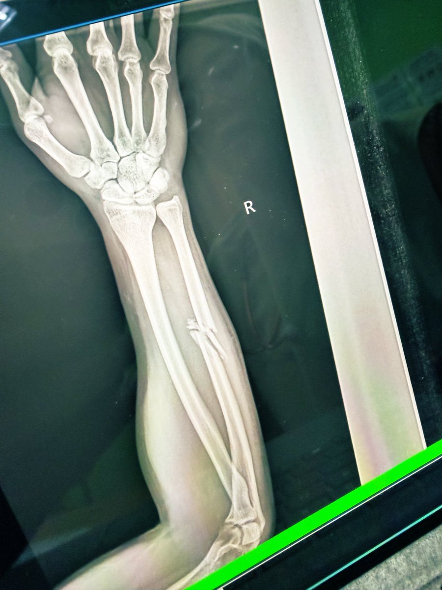 M 🇲🇾🏴 tweet media