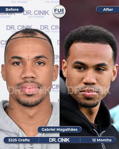 AVFCVillano's tweet image. 2 wins in 6 games vs Aston Villa.

Put the hair follicles in the bag😭😭 @biel_m04