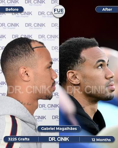 AVFCVillano's tweet image. 2 wins in 6 games vs Aston Villa.

Put the hair follicles in the bag😭😭 @biel_m04