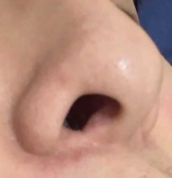 小跑出來了 tweet media