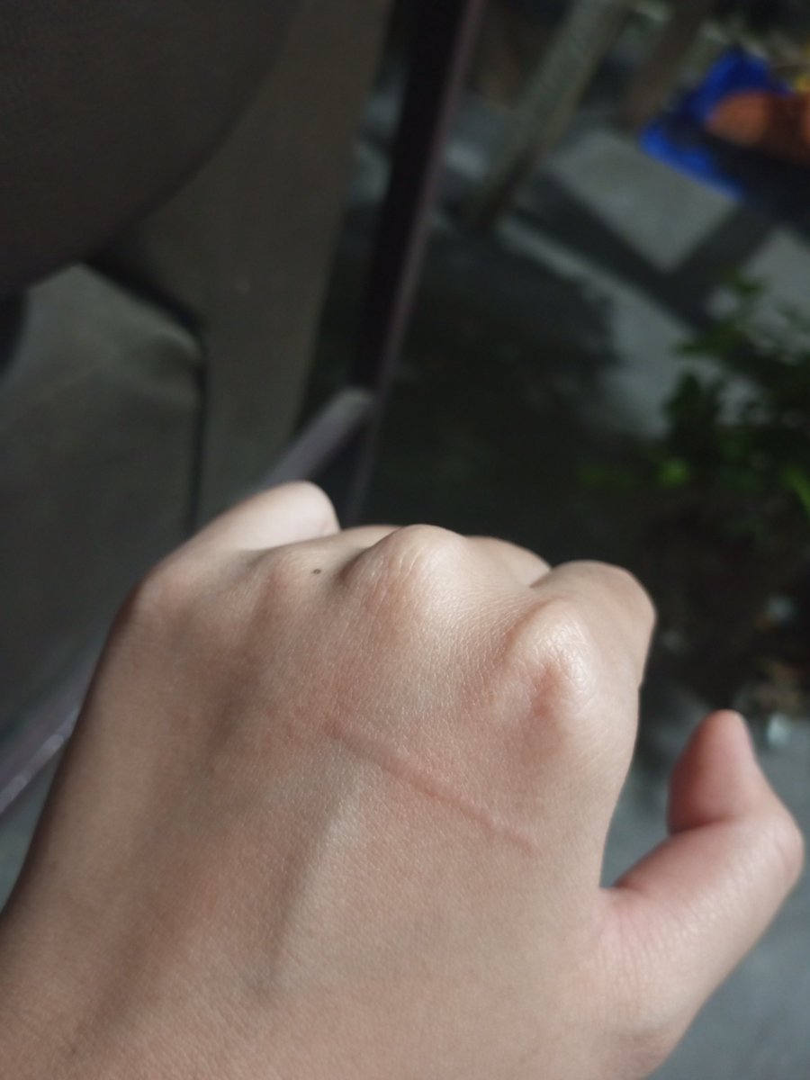 crushedpixie's tweet image. New tatto unlocked😔 panas bgt bjir