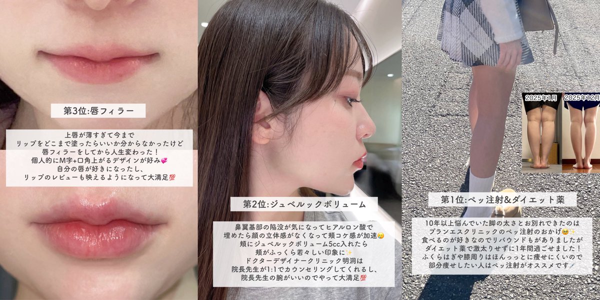 公式】プランエスクリニック（PLAN;SCLINIC） (@plansjp) / Highlights / X