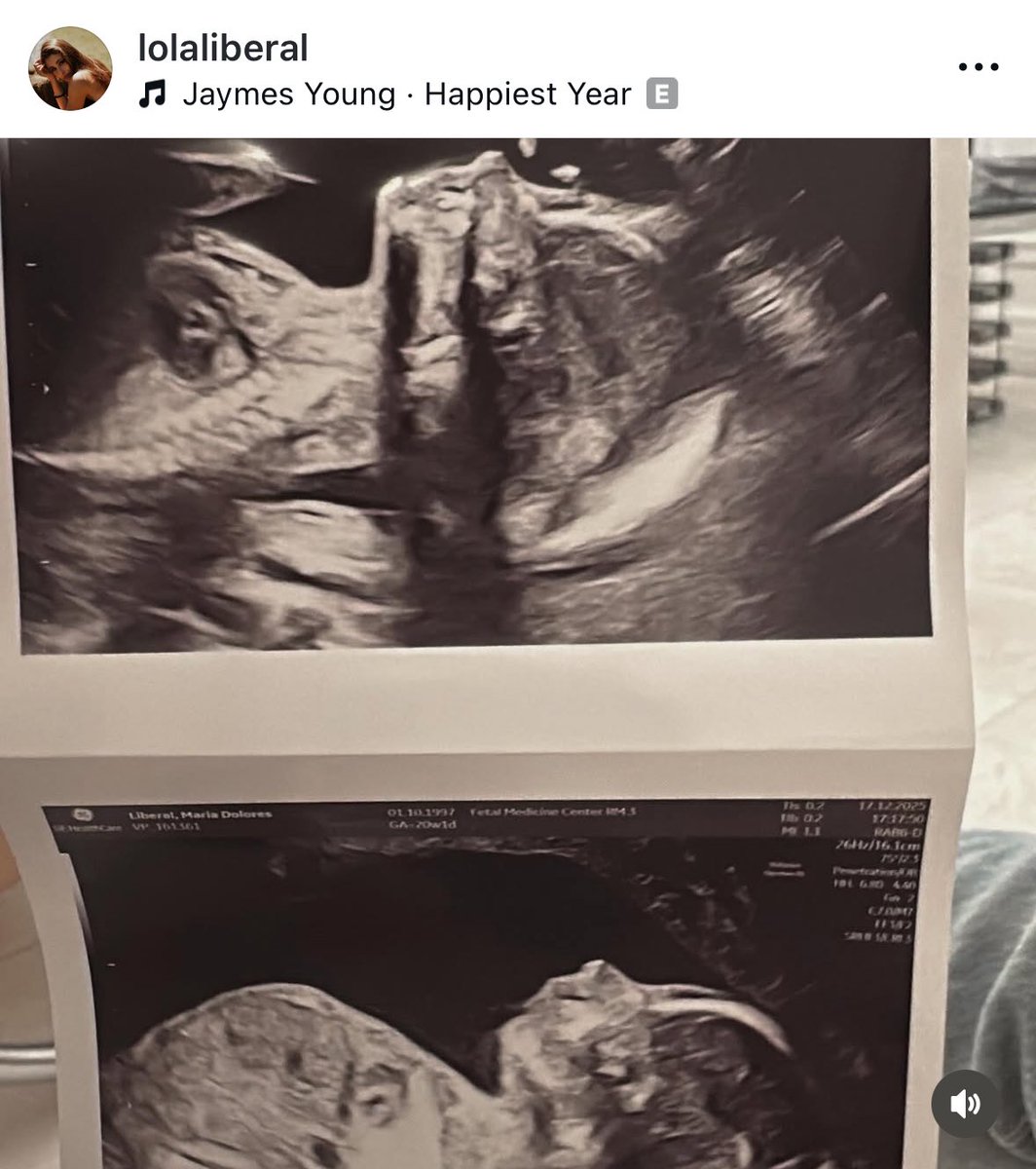 afcstuff's tweet image. 📲 Mikel Merino &amp;amp; his partner, Lola, confirming they are expecting their first child in the new year. 👶

“And this year especially a million thanks for Marco, we wait for you with lots of excitement and love. The greatest gift ever.”

A massive congratulations! 🥹❤️