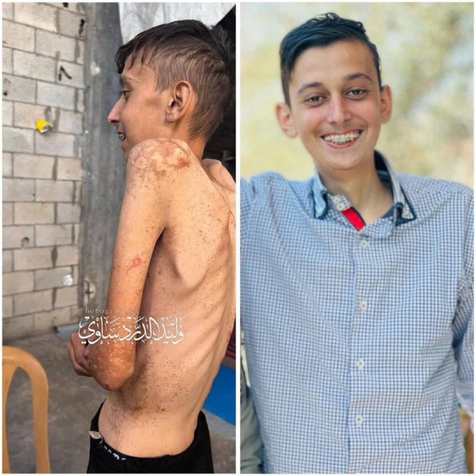 مااااات من الجوع 
حتى لاننسى!!!