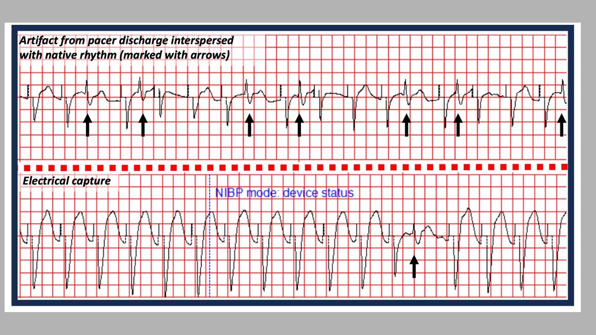 Tanner Smida tweet media
