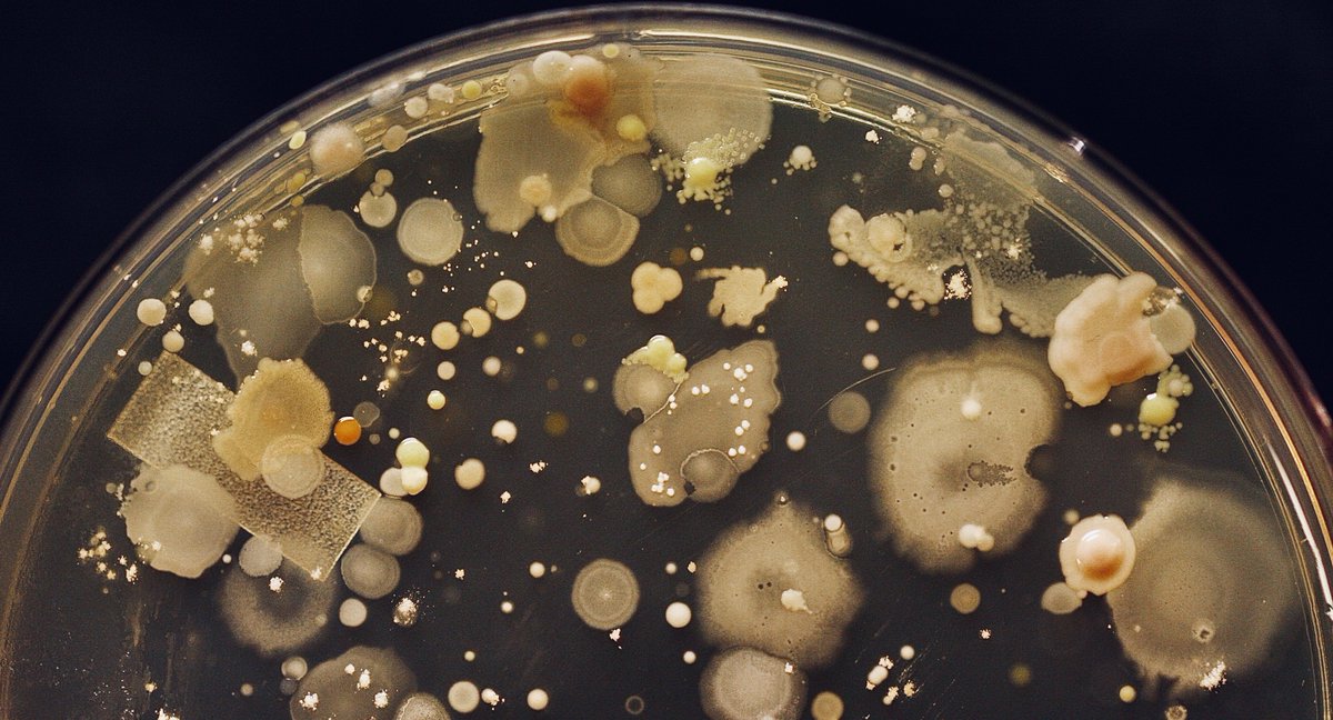 tasturm1's tweet image. #DescribeThatMicrobe Happy New Year, may all your microbial swabs be pretty (Table top). @ASMicrobiology @ContamClub