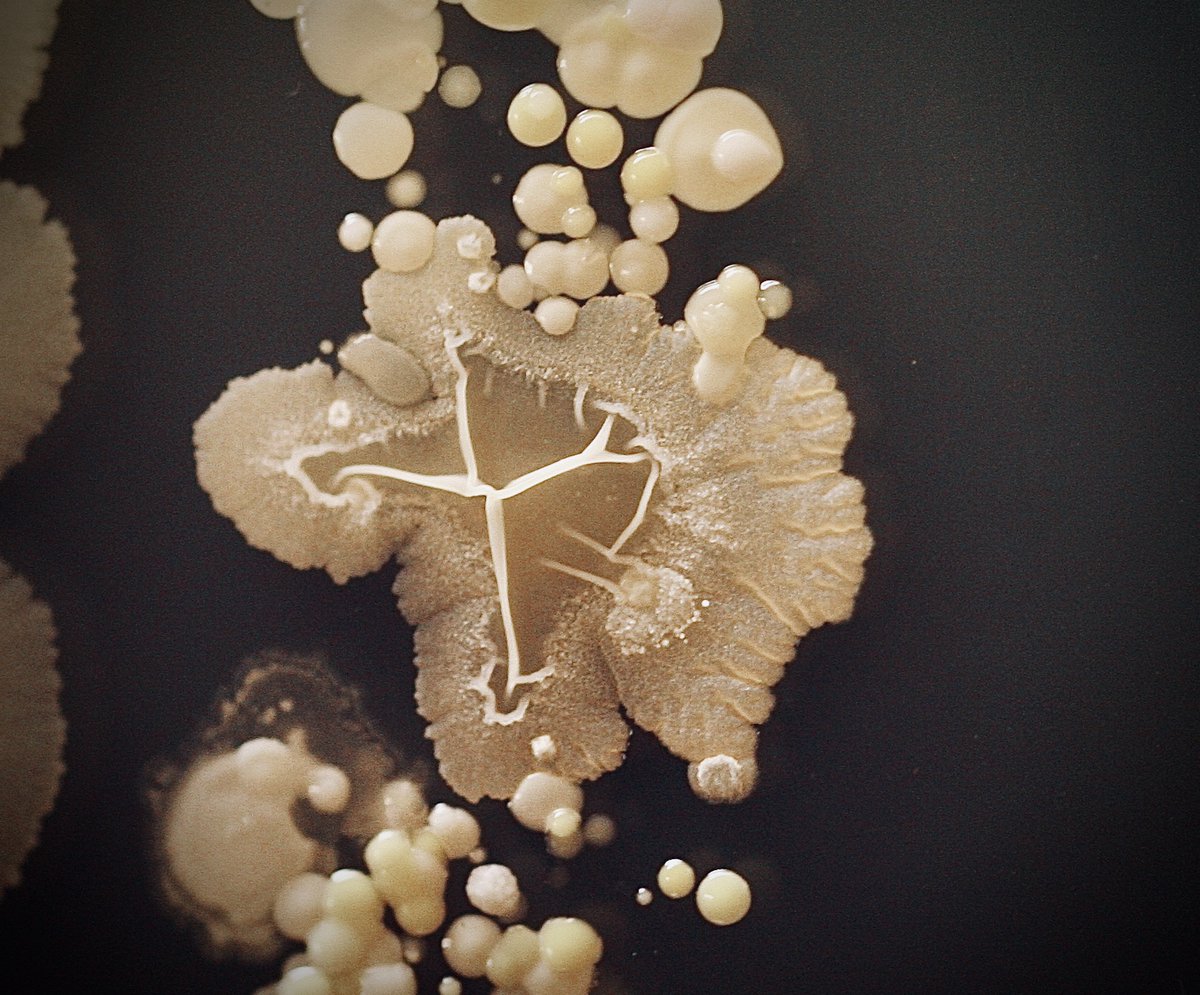 tasturm1's tweet image. #DescribeThatMicrobe Bacillus on microbial finger prints, my favorite! @ASMicrobiology @ContamClub #SciComm #Microbiology