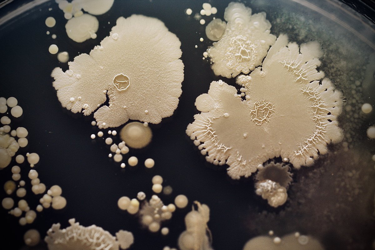 tasturm1's tweet image. #DescribeThatMicrobe Bacillus on microbial finger prints, my favorite! @ASMicrobiology @ContamClub #SciComm #Microbiology
