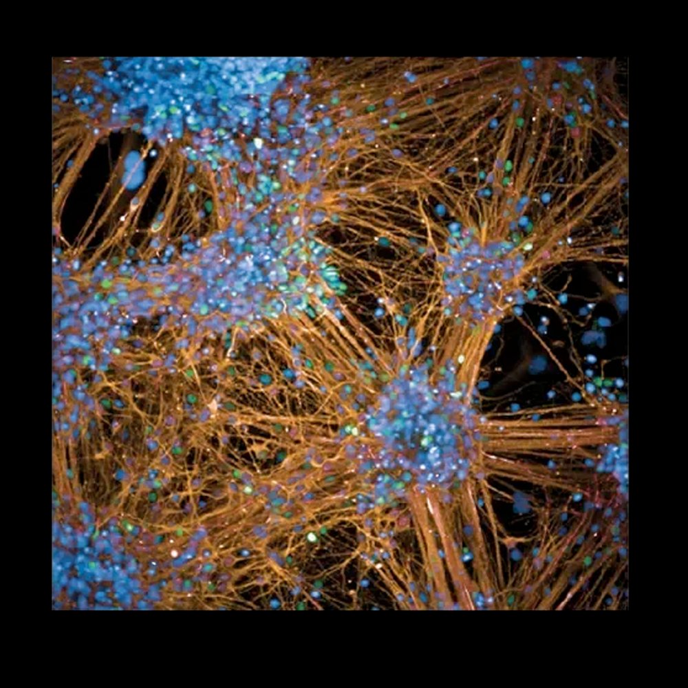 jacksonlab's tweet image. We know it's New Years Eve, but these aren't fireworks 🎇! 

Check out this microscopy image of neural progenitor cells — multipotent, self-renewing cells in the central nervous system that generate neurons and glial cells in the 🧠. 

Credit: Pera Lab at JAX