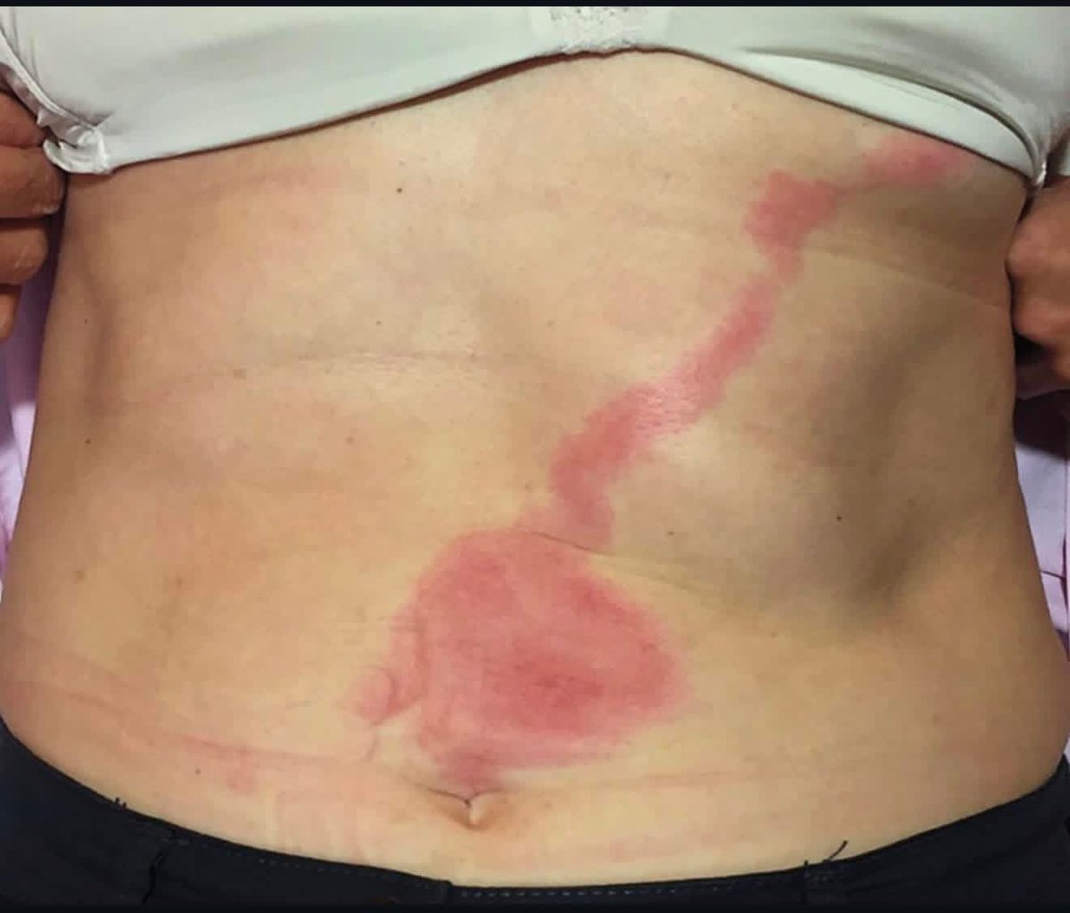 Dr.Haitham Hamoud | د.هيثم tweet media