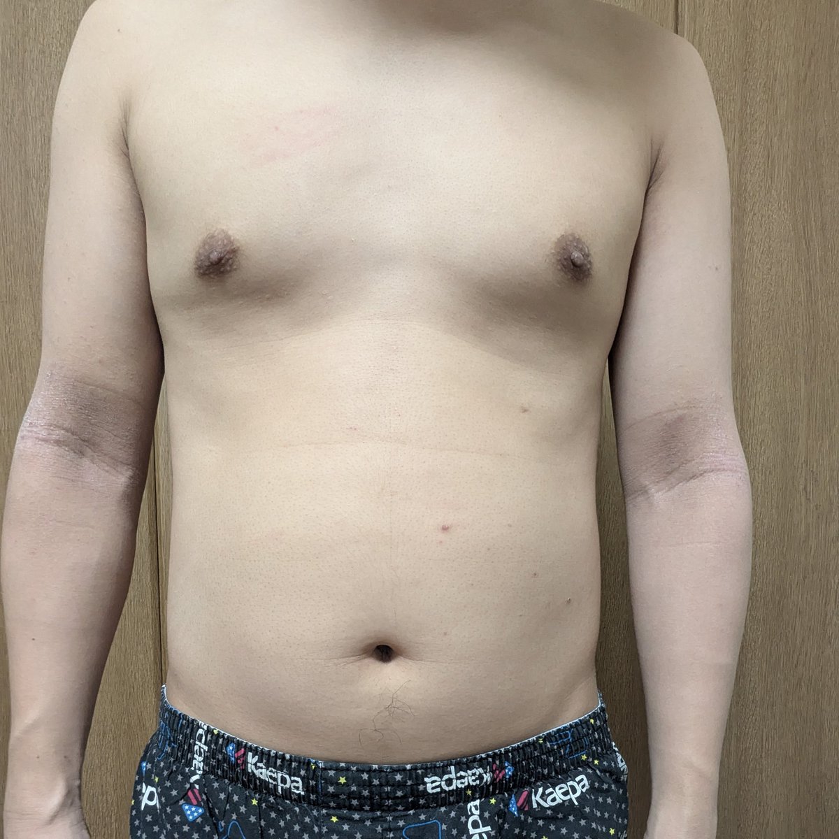 temolife1's tweet photo. 20260101
162.7cm
62.6kg https://t.co/5BTR1T3Foy