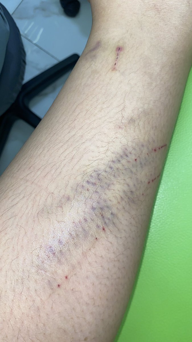 matcha_1401's tweet photo. kucing sialan😔✋🏻 https://t.co/XZ6EFIhSRC