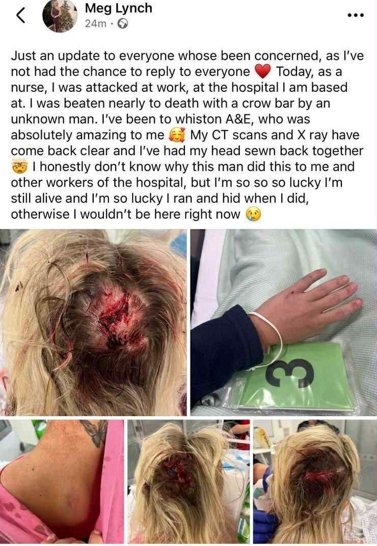 TheGriftReport's tweet image. 🚨 ATTACKS ON NHS STAFF SURGE BY A FIFTH – THEY FACE VIOLENCE EVERY DAY!!

Shocking figures: Over 15,000 more assaults and threats in 2024 vs 2022 – one in seven staff physically attacked, up from last year.

Worst at mental health trusts: Thousands of incidents including sexual…