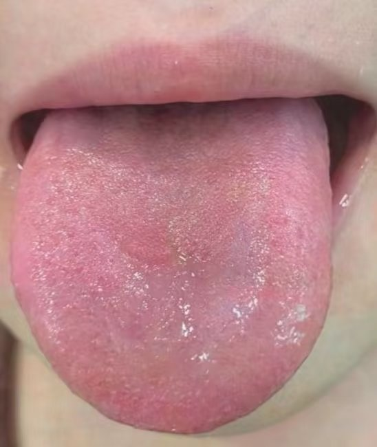 婷婷老阿姨 tweet media