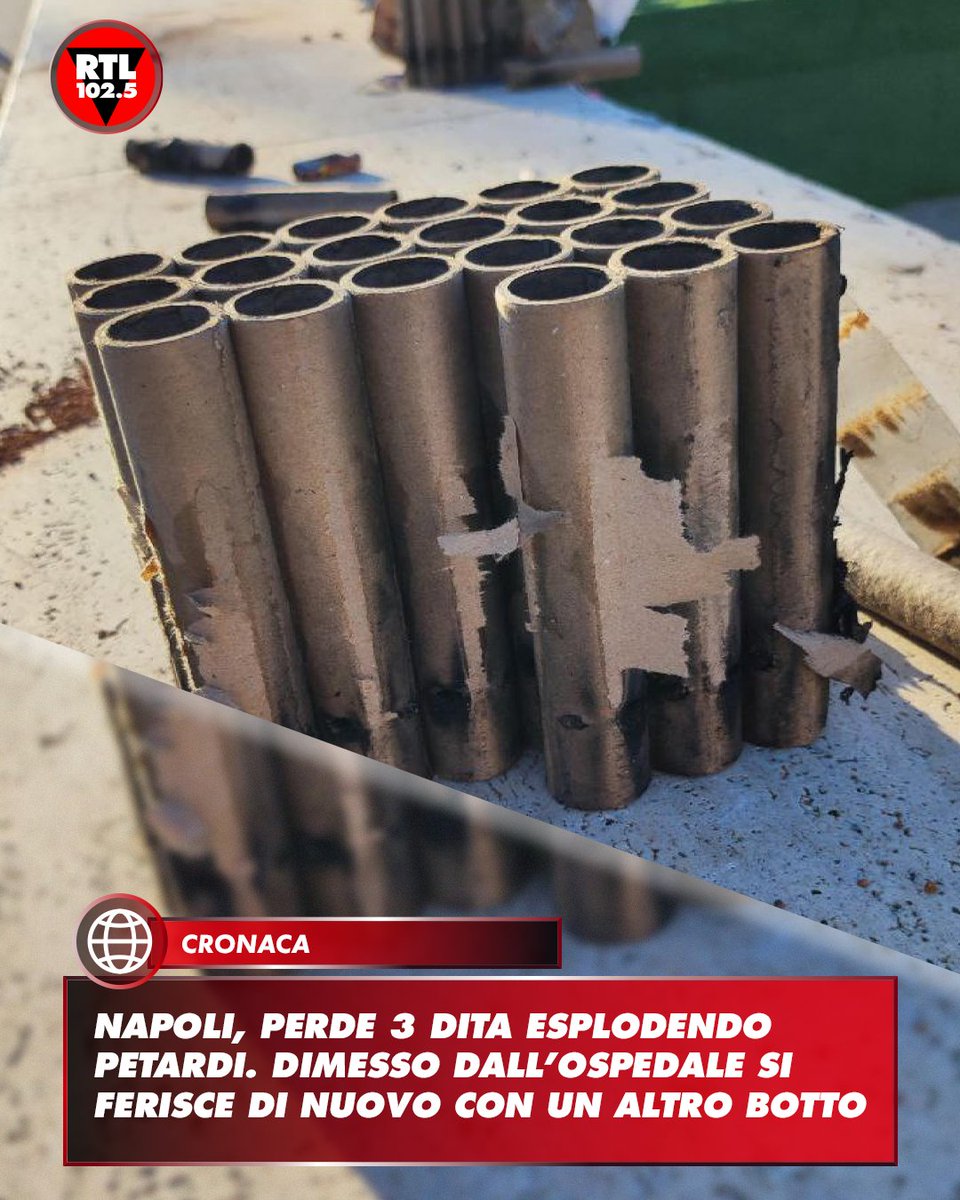 rtl1025's tweet image. 📌 Un 24enne napoletano è diventato protagonista di una storia al limite del credibile. Dopo aver perso 3 dita in seguito all'esplosione di un petardo ed essere stato dimesso dall'ospedale Pellegrini di Napoli, ha deciso di accendere un altro fuoco pirotecnico, questa volta…