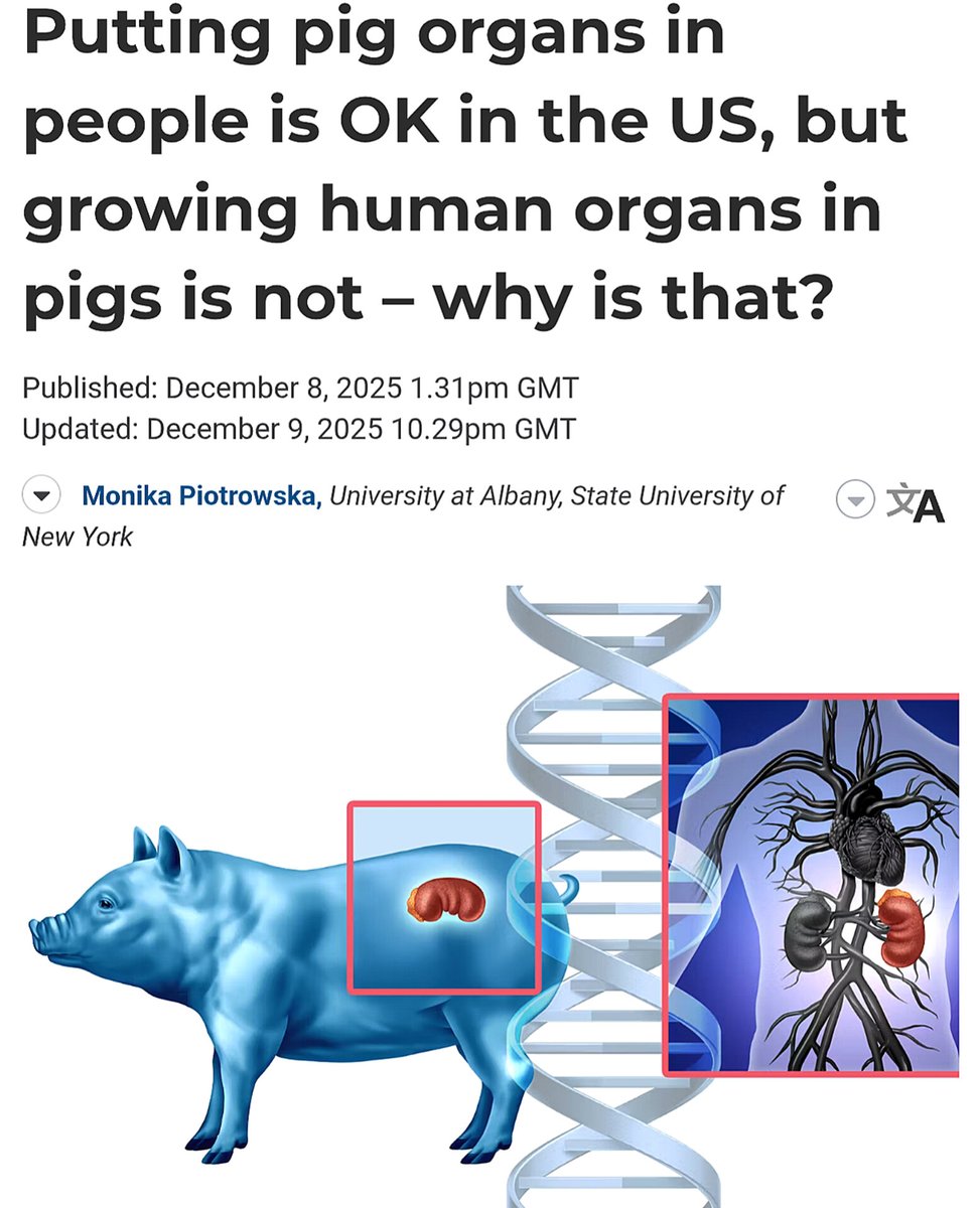 SciTechera's tweet image. CRISPR changed it.

Scientists in the US are using CRISPR gene editing to modify pig organs so they can function inside the human body. CRISPR allows researchers to delete pig genes that trigger immune rejection and add human compatible genes, making the organs safer for…