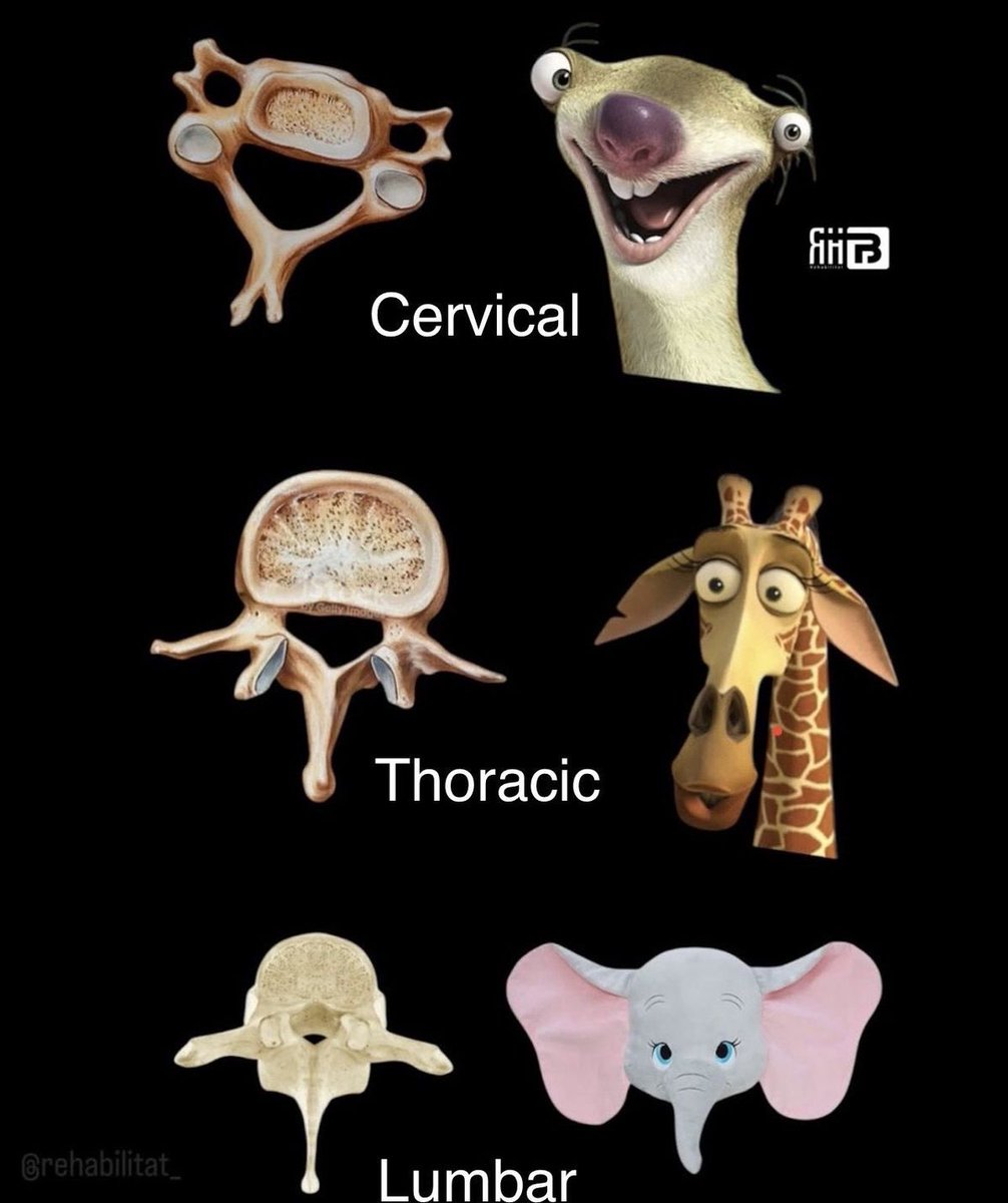 Spine shapes