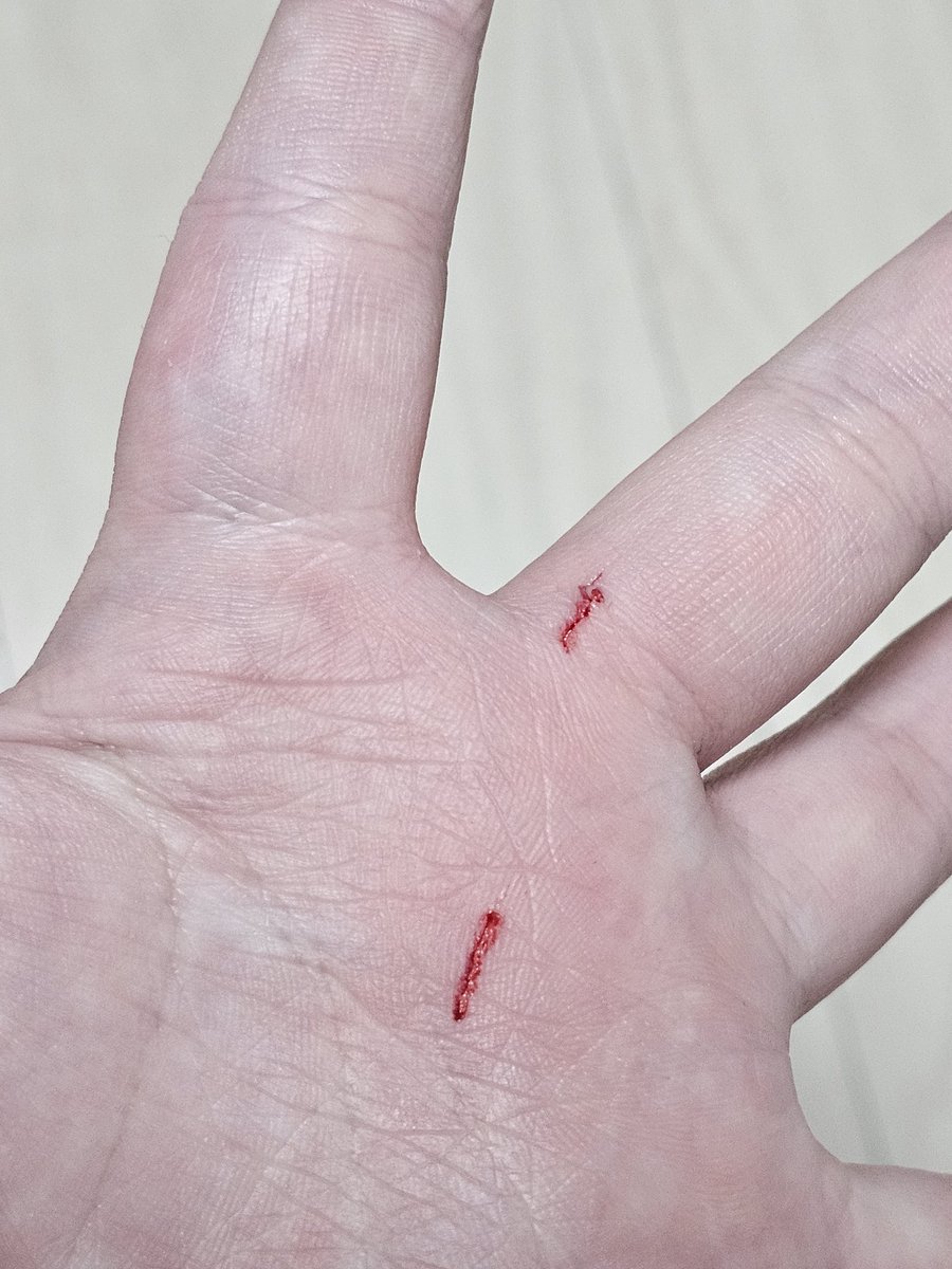 고양이한테 물렸어요