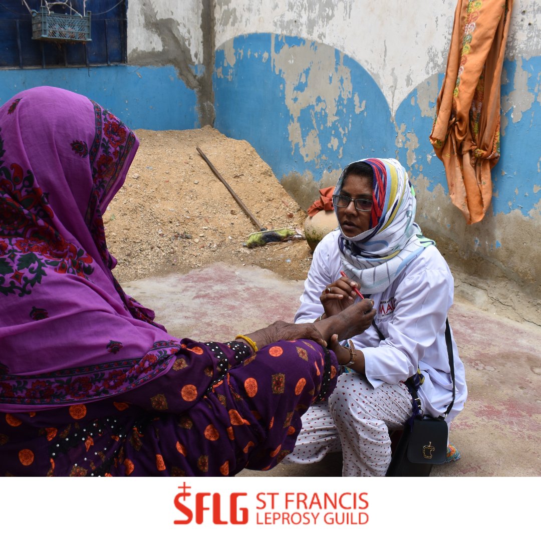 Leprosy is curable.
Early detection and treatment are absolutely critical. No one should suffer needlessly from a disease we know how to treat.
At SFLG, we stand with those affected by leprosy because healing is not just medical; it’s social.
#StopLeprosy
#Catholic 
<a href="/garydench/">Fr Gary Dench</a>