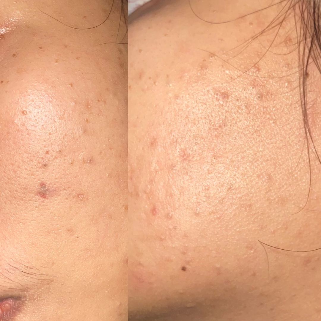 ✨OMBB | 🚫NO LINK tweet media