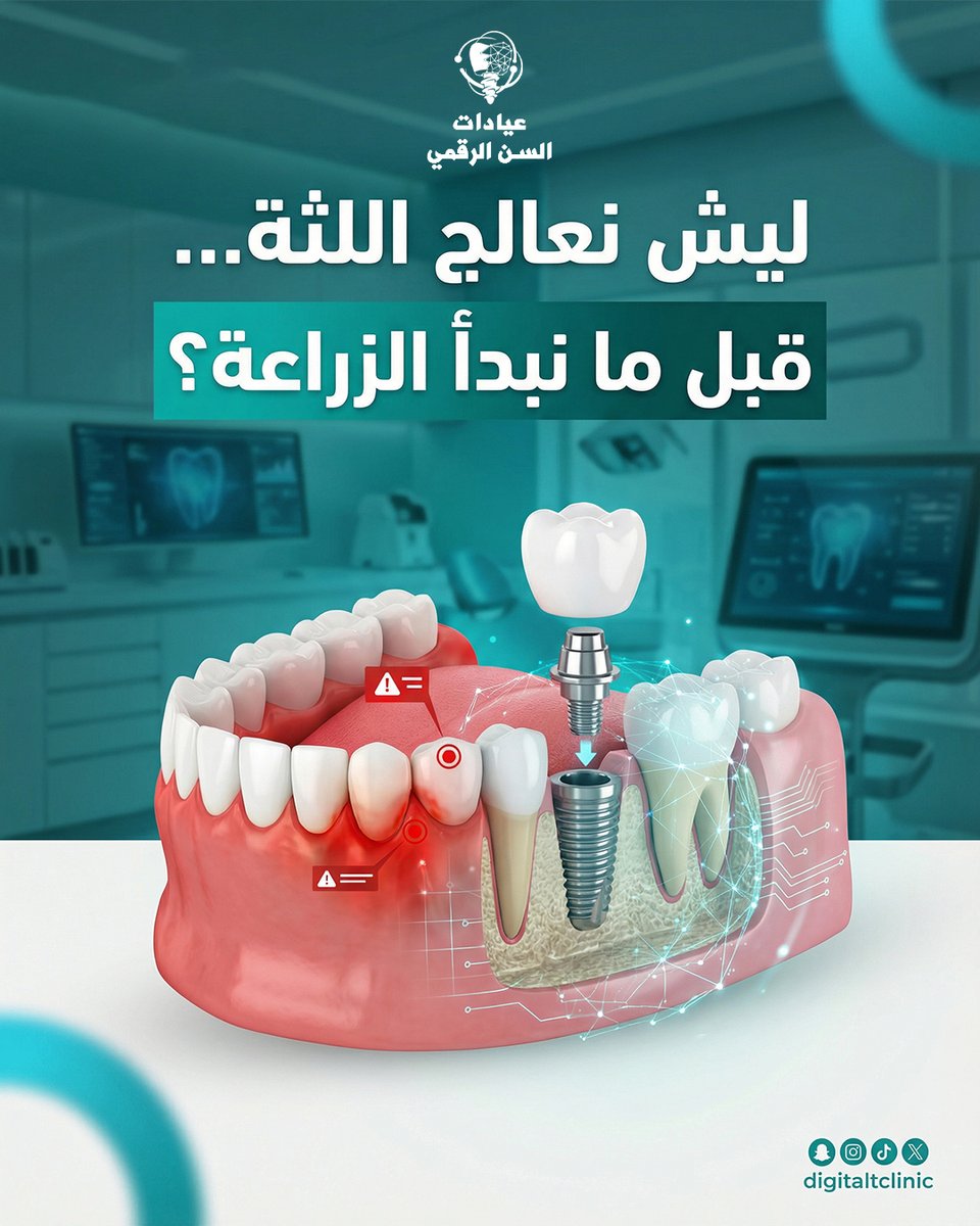 السن الرقمي | Digital Tooth tweet media