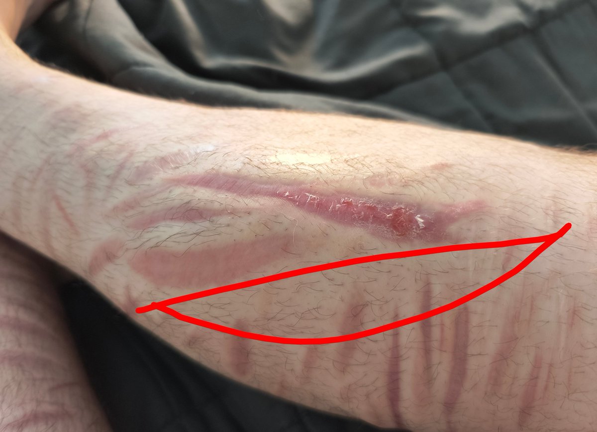 Bigger Fishes 𓆝 𓆟 𓆞 (-19/56 lbs) tweet media