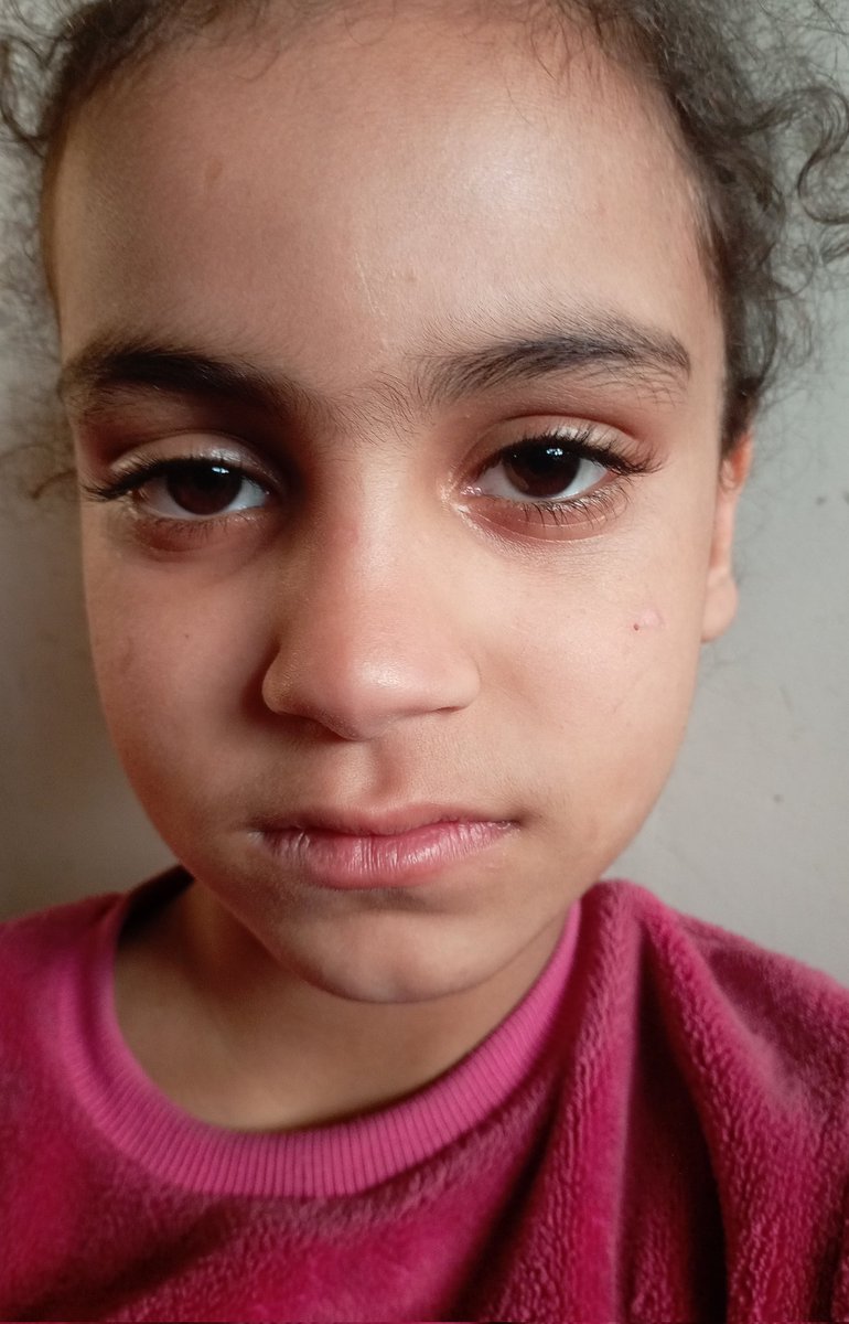 With the changing weather and low pressure systems, my children are getting sick easily, and my poor little girl, Tulin, is ill and needs treatment. Please help me. 
🙏😭
chuffed.org/project/138194…