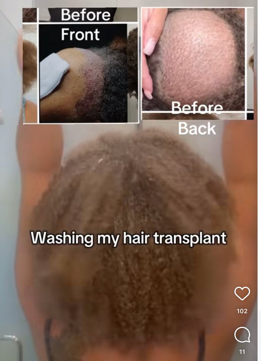 SkipyouDraw4's tweet image. The Huzz going to Turkey too