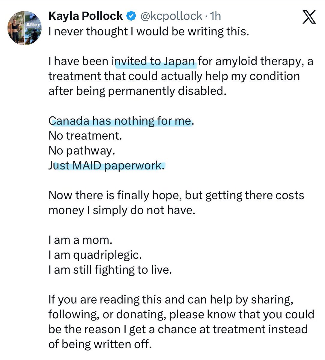 Another Canadian that was offered MAID instead of actual care 🇨🇦 But now, Kayla Pollock has been invited to JAPAN 🇯🇵 for treatment 🙏🏼 

Kayla was paralyzed for life after the COVID vaccine. All Canada could offer was government death 😒  Wishing you all the best, Kayla