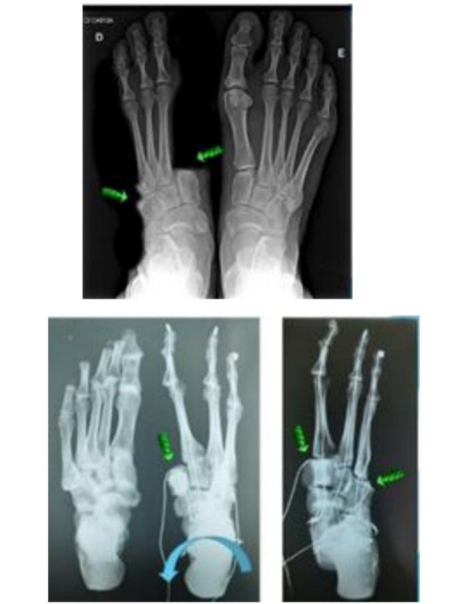 Ignacio Rodríguez de-Rementería ex-@micronauta tweet media