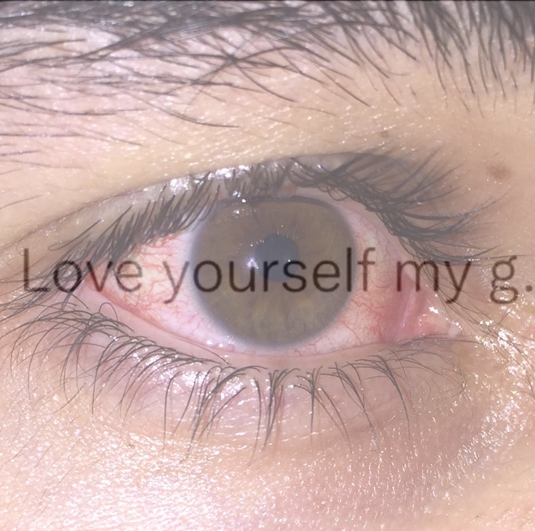 dean blunt dinlerken agliyorum genel bi sıkıntı mevcut veya dean bluntun dehalıgının etkisi olabilir bilemiyorum ikinci daha agir basiyor