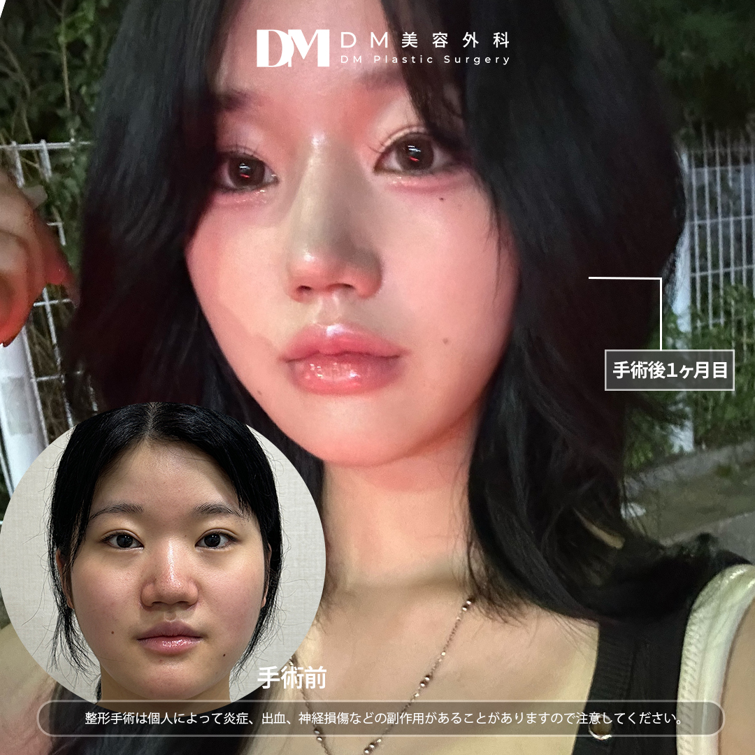 DM美容外科 (@dm1004jp) / Posts / X, image size:1080x1080