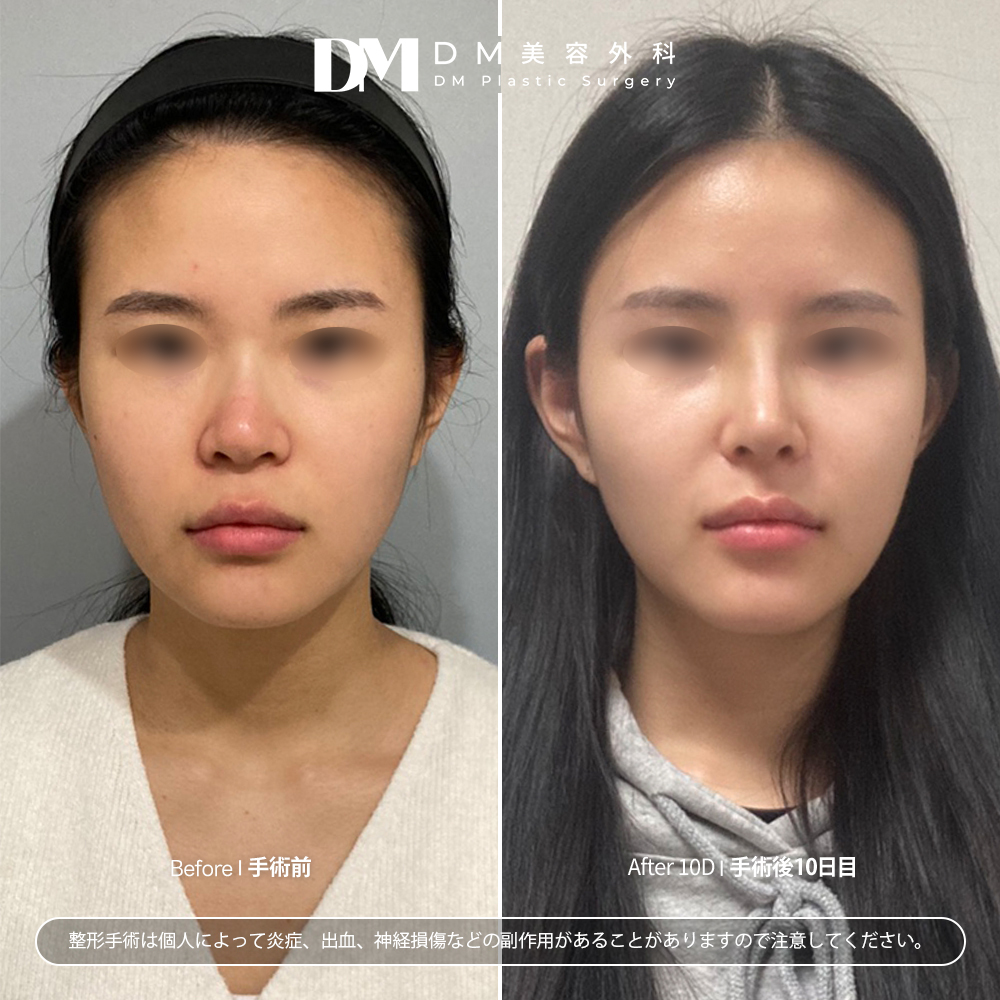 DM美容外科 (@dm1004jp) / Posts / X, image size:1000x1000